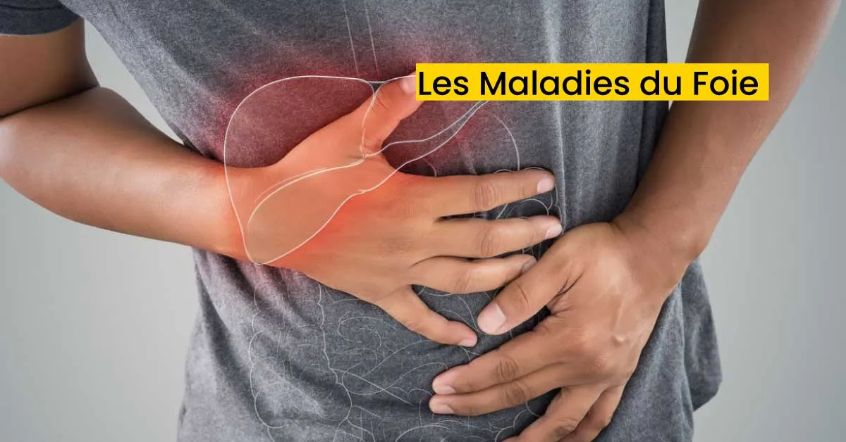 Les Maladies du Foie